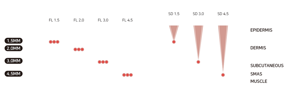 ndb-mvbukyxg