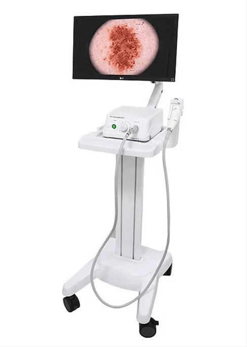 Video Colposcope Dr. Camscope Pro by MEDILIFE — image 2