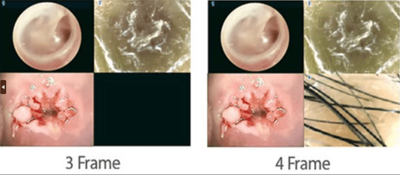 Video Colposcope Dr. Camscope Pro by MEDILIFE — image 6