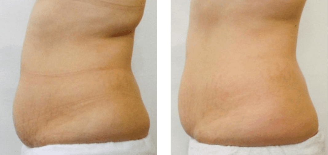 Powershape 2 by MEDILIFE — image 6