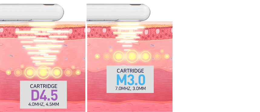 Ultra Vera 2 by MEDILIFE — image 6