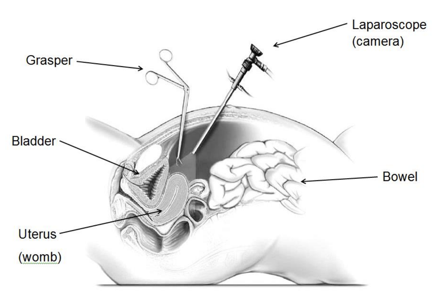 VES-100 2D Endoscopy Camera System by MEDILIFE — image 5