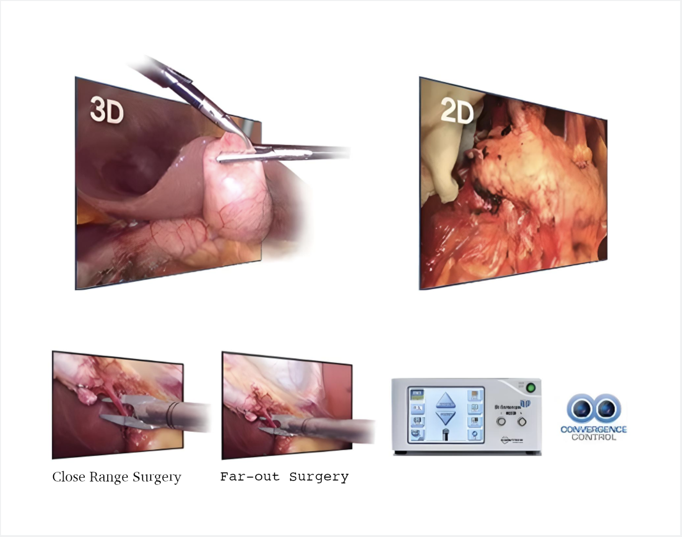VLS-200 3D Laparoscopy System by MEDILIFE — image 2