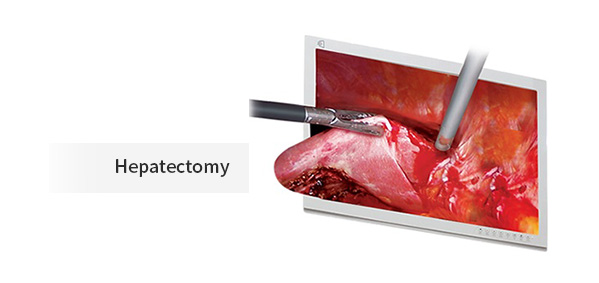 VLS-200 3D Laparoscopy System by MEDILIFE — image 7