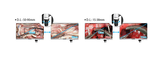 VOMS-101D 3D Operating Microscope (Dental) by MEDILIFE — image 6